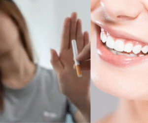 <img src="your-image.jpg" alt="Young adult with gum pain holding jaw — early signs of gum disease" title="Why Young Adults Are Facing Gum Disease Early"> 