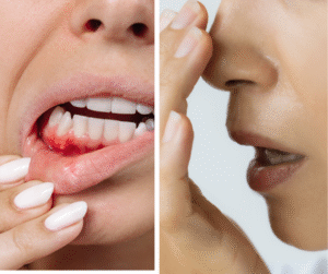 <img src="your-image.jpg" alt="Young adult with gum pain holding jaw — early signs of gum disease" title="Why Young Adults Are Facing Gum Disease Early"> 